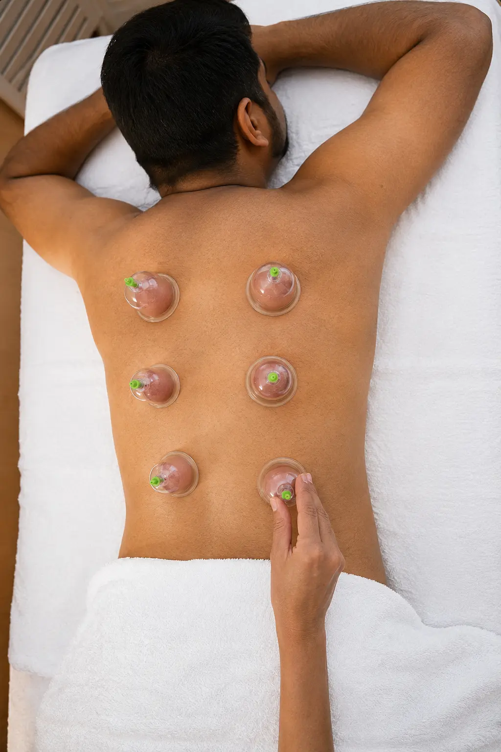 Dry Cupping therapy at Cureवेदा, Andheri West